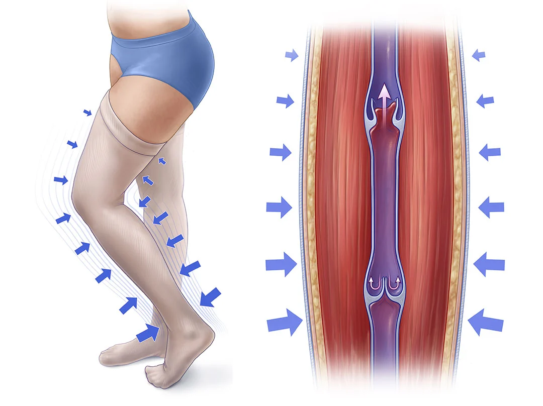 Effect of Compression